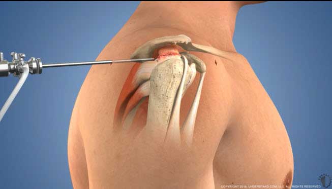 عمل‌های ترمیمی تاندون و اعصاب محیطی